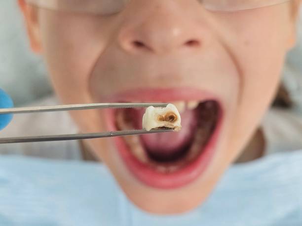 Best Emergency Pediatric Dental Care in Newark, NJ